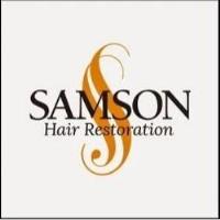 Samson Hair Restoration image 1